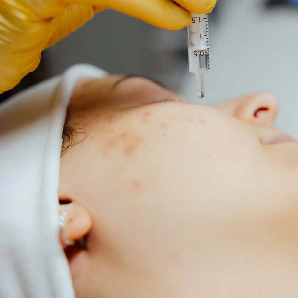 HIALURONSAVAS nano kezelés HIALURONSAVAS nano kezelés