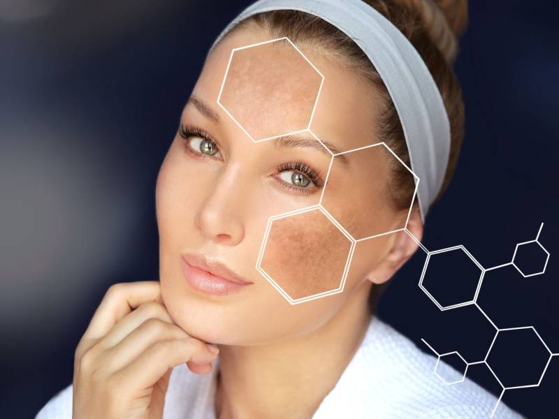 Pigmentfoltok kezelése szakértő módszerekkel